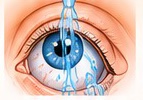 Illustration of immediate eye irrigation after chemical exposure